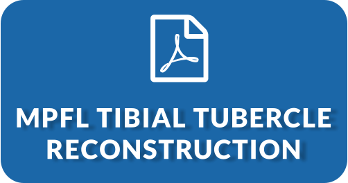 MPFL Tibial Tubercle Reconstruction (PDF)