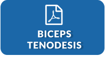 Biceps Tenodesis (PDF)