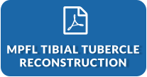 MPFL Tibial Tubercle Reconstruction (PDF)